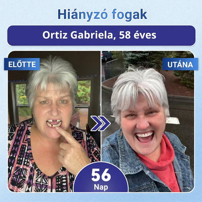 ⏰ Gratulálunk! Exkluzív ajánlatot nyitottál a Coauoo® számára! Rendelésedért ma további 50%-os kedvezményt adunk! Kattints az alábbi linkre, hogy kihasználd ezt a különleges ajánlatot, az ajánlat hamarosan lejár! ⏰