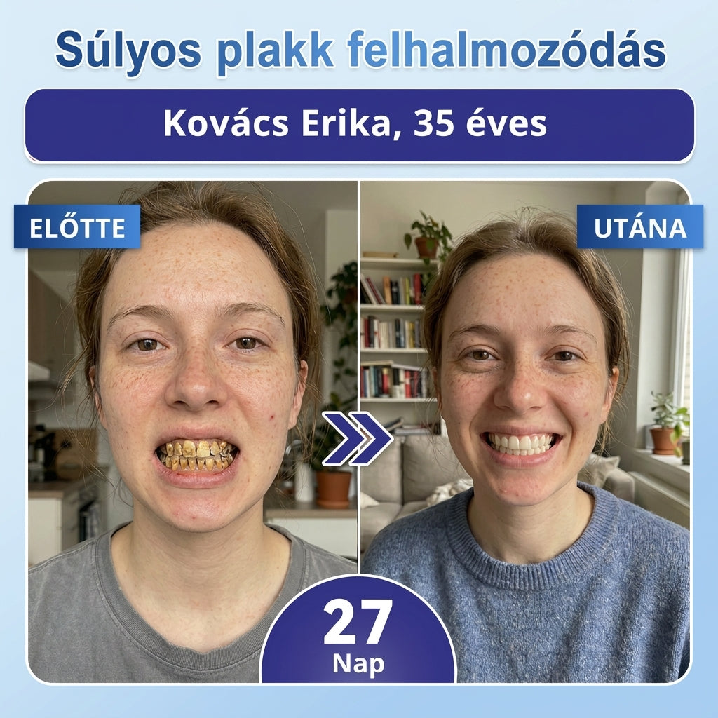 ⏰ Gratulálunk! Exkluzív ajánlatot nyitottál a Coauoo® számára! Rendelésedért ma további 50%-os kedvezményt adunk! Kattints az alábbi linkre, hogy kihasználd ezt a különleges ajánlatot, az ajánlat hamarosan lejár! ⏰