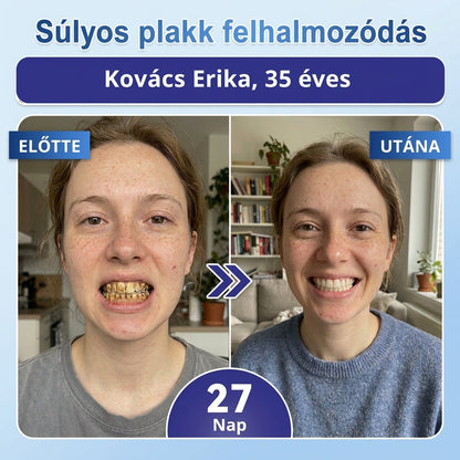 ⏰ Gratulálunk! Exkluzív ajánlatot nyitottál a Coauoo® számára! Rendelésedért ma további 50%-os kedvezményt adunk! Kattints az alábbi linkre, hogy kihasználd ezt a különleges ajánlatot, az ajánlat hamarosan lejár! ⏰