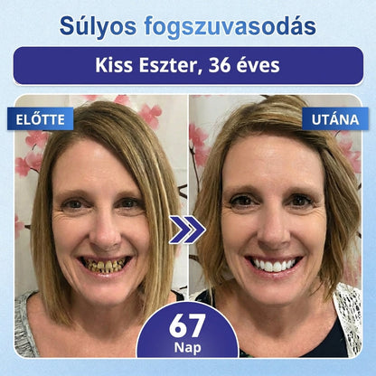 ⏰ Gratulálunk! Exkluzív ajánlatot nyitottál a Coauoo® számára! Rendelésedért ma további 50%-os kedvezményt adunk! Kattints az alábbi linkre, hogy kihasználd ezt a különleges ajánlatot, az ajánlat hamarosan lejár! ⏰