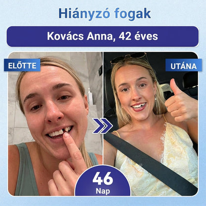 ⏰ Gratulálunk! Exkluzív ajánlatot nyitottál a Coauoo® számára! Rendelésedért ma további 50%-os kedvezményt adunk! Kattints az alábbi linkre, hogy kihasználd ezt a különleges ajánlatot, az ajánlat hamarosan lejár! ⏰