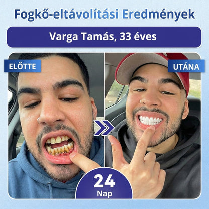 ⏰ Gratulálunk! Exkluzív ajánlatot nyitottál a Coauoo® számára! Rendelésedért ma további 50%-os kedvezményt adunk! Kattints az alábbi linkre, hogy kihasználd ezt a különleges ajánlatot, az ajánlat hamarosan lejár! ⏰