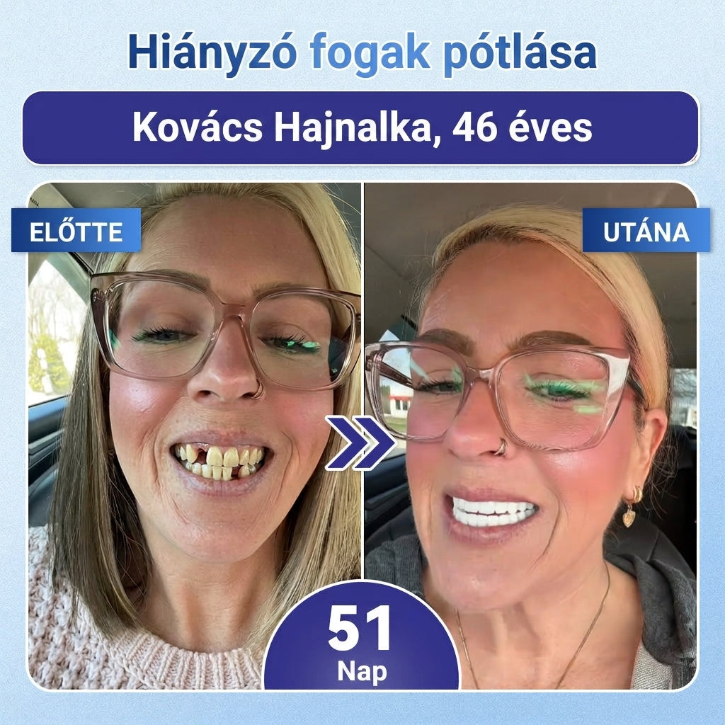 ⏰ Gratulálunk! Exkluzív ajánlatot nyitottál a Coauoo® számára! Rendelésedért ma további 50%-os kedvezményt adunk! Kattints az alábbi linkre, hogy kihasználd ezt a különleges ajánlatot, az ajánlat hamarosan lejár! ⏰