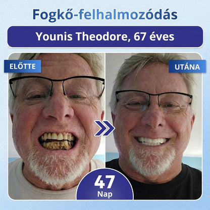 ⏰ Gratulálunk! Exkluzív ajánlatot nyitottál a Coauoo® számára! Rendelésedért ma további 50%-os kedvezményt adunk! Kattints az alábbi linkre, hogy kihasználd ezt a különleges ajánlatot, az ajánlat hamarosan lejár! ⏰